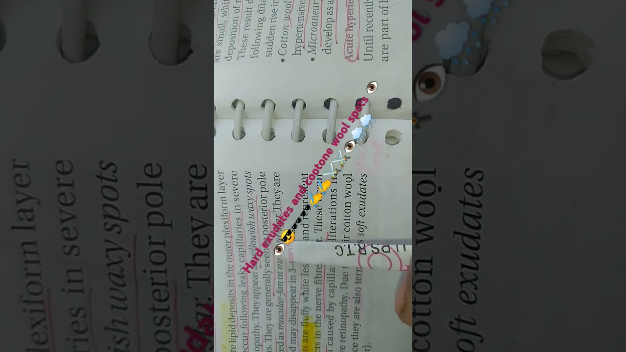 Hard exudates cotton wool spots 😎😎🕶️✍️✍️⚔️⚔️👁️🌧️🌧️