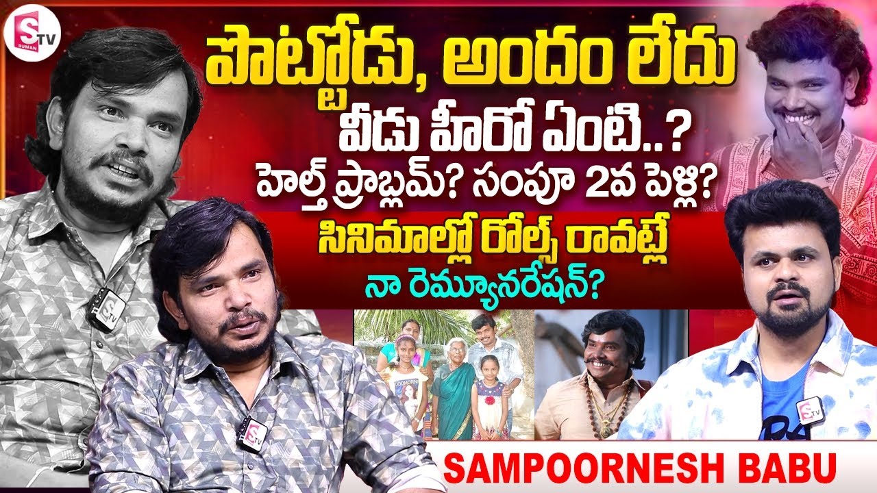 Burning Star Sampoornesh Babu Exclusive Interview | Anchor Roshan | Telugu Interviews