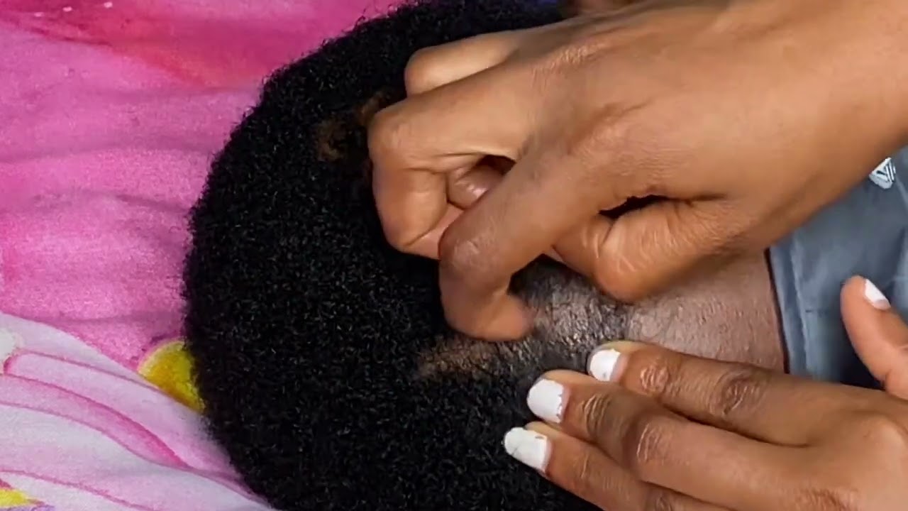 THE MOST SATISFYING FINGER SCALP SCRATCH || ASMR