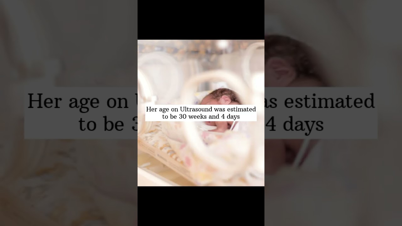 Story of a 30 weeks premature Baby  #PROM