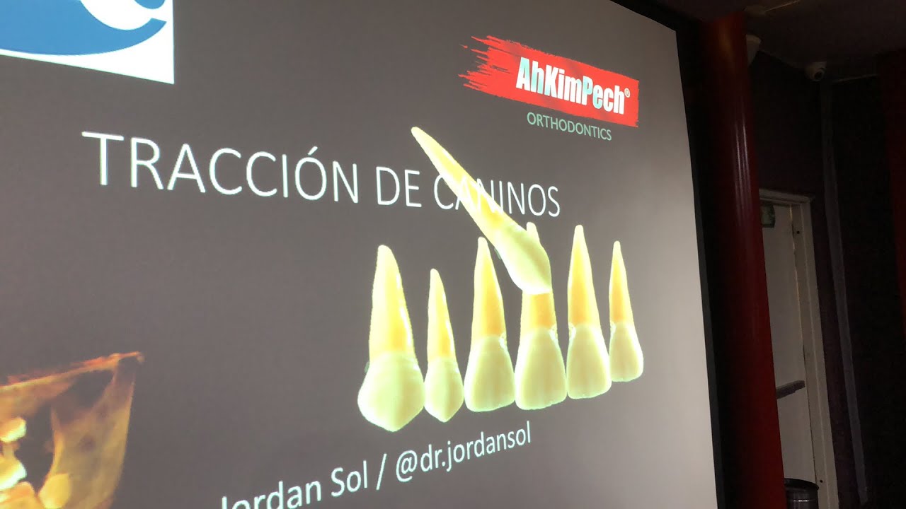 Conferencia del doctor Jordán Sol, desde Ah-Kim-Pech: tracción de caninos. Primera parte.