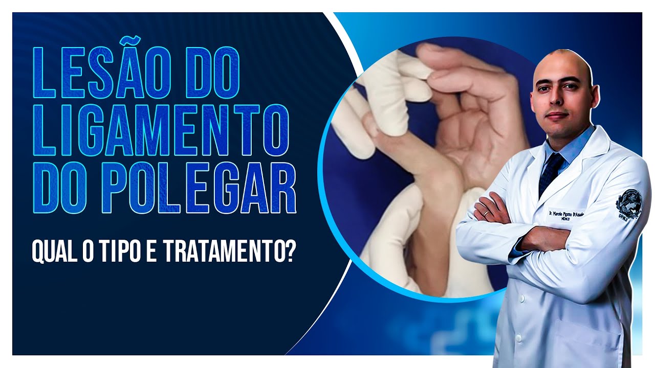 LESÃO DO LIGAMENTO DO POLEGAR | QUAL O TIPO? QUAL O TRATAMENTO?