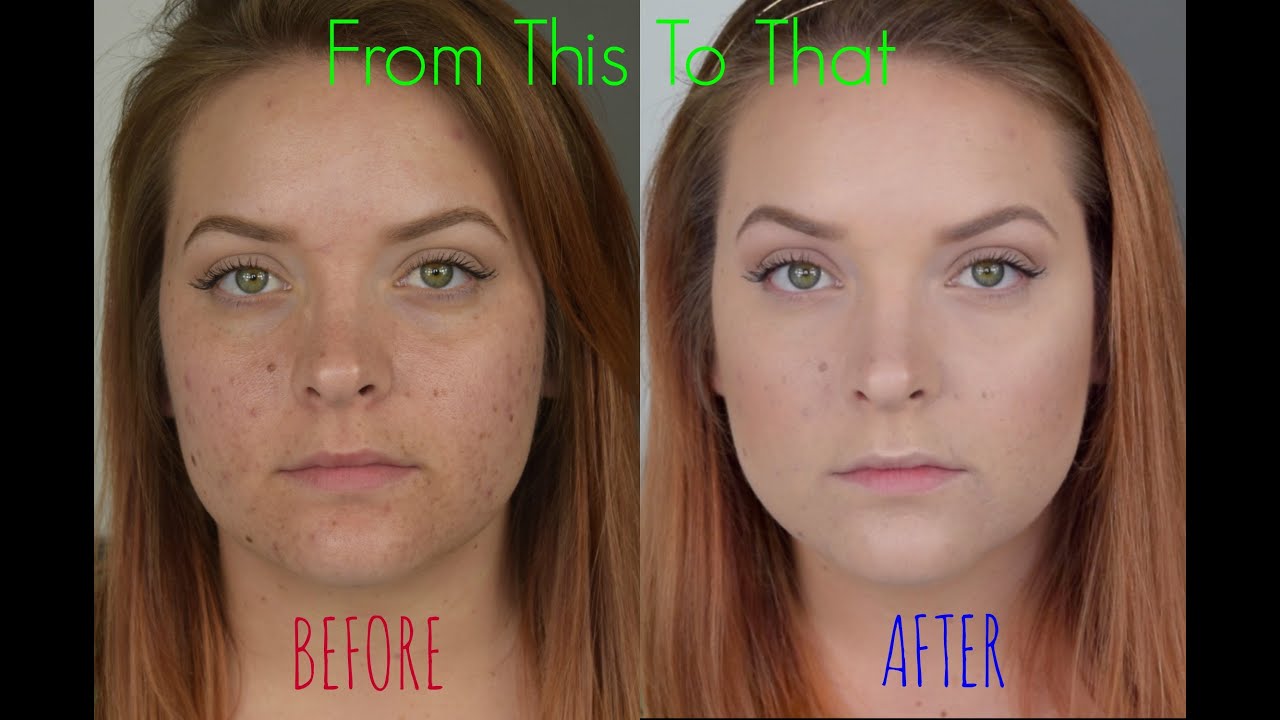 MY FOUNDATION ROUTINE | Acne Coverage + Color Correcting | Samantha Ames