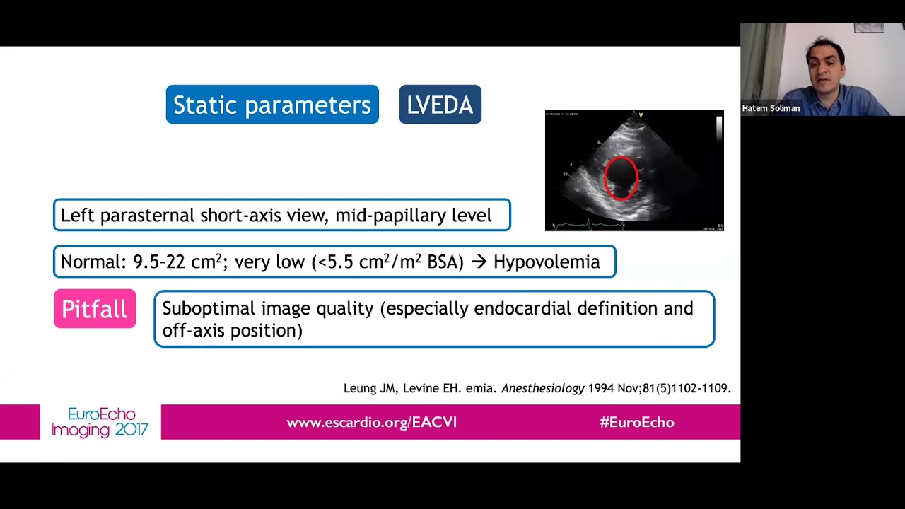 How to assess volume status by echo - Dr. Hatem soliman