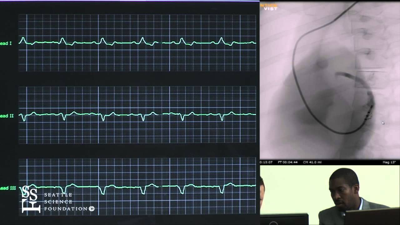 Device Implant Simulation Demonstration by Eric Williams, M.D.