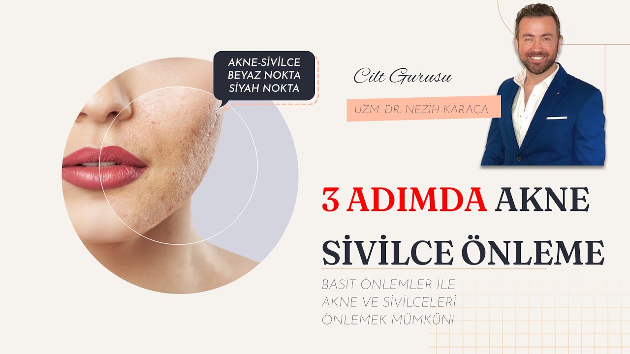 Sivilce\ Akne oluşumunu önlemek için 3 temel basit uygulama!