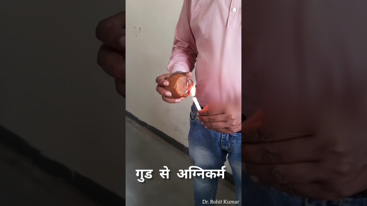 Gud se Agnikarma। Frozen shoulder Patient । Shree Ambar Ayurveda। Dr. Rohit Kumar