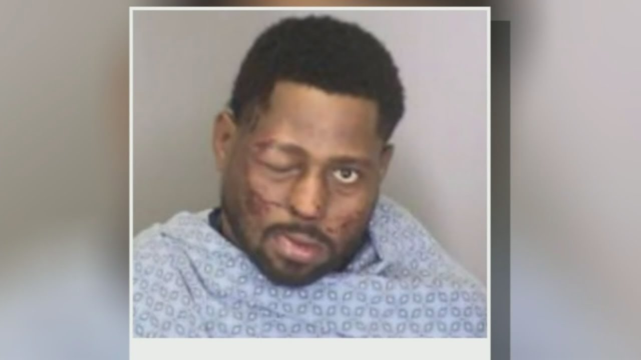 Man claims Merced Police used excessive force while he was on trip for tea