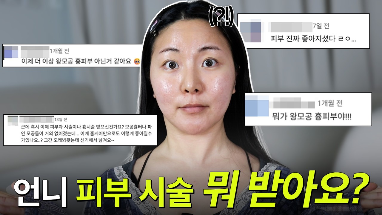 언니...요즘 피부 시술 뭐 받았어요⁉️ (관리법 싹 풉니다)
