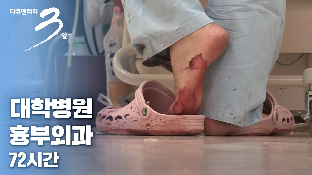 [다큐3일📸] 집은 당직실, 일상복은 수술복, 밥은 물 한잔.. 그저 환자의 심장을 다시 뛰게 하겠다는 생각 뿐! 대학병원 흉부외과 72시간 | KBS 2017.07.16 방송