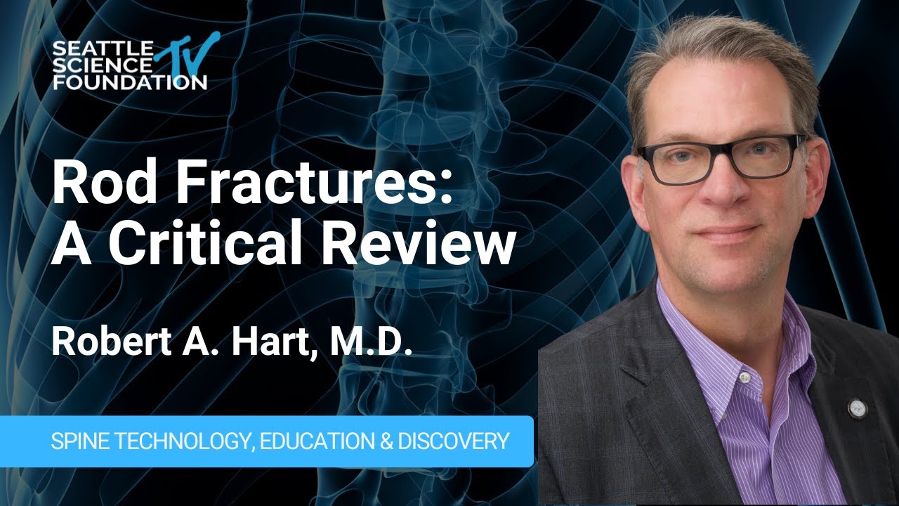 Rod Fractures: A Critical Review - Robert A. Hart, M.D.