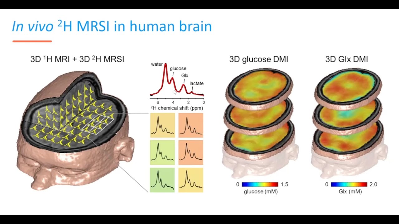 KIS - Prof. Jeanine Prompers - Metabolic MRI towards clinical translation