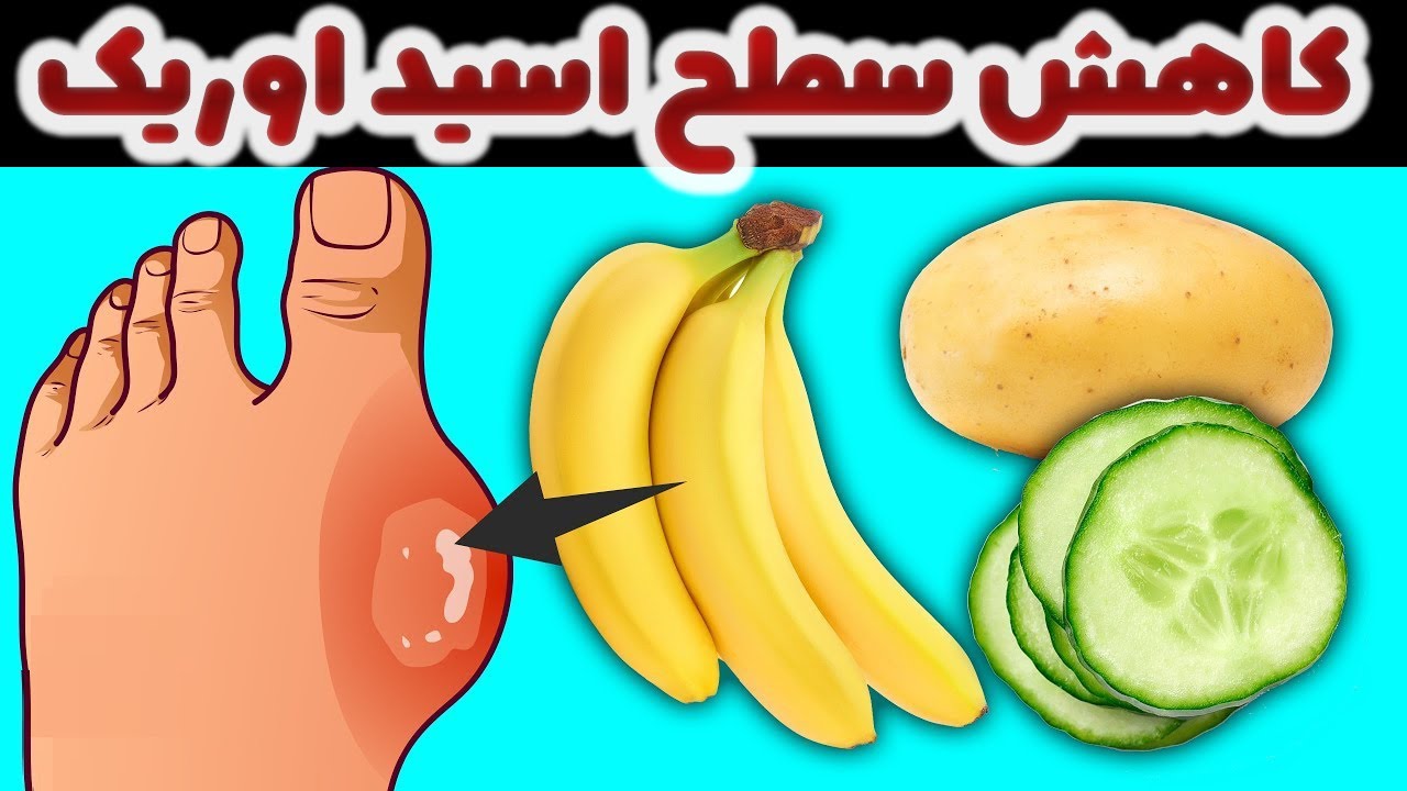 با این 20 غذا سطح اسید اوریک را کاهش دهید - روزانه آنها را بخورید
