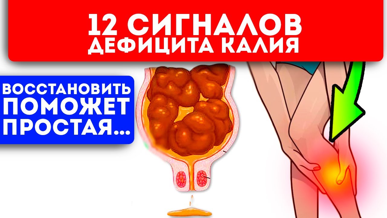 12 сигналов того, что в организме закончился калий+ продукты, богатые калием