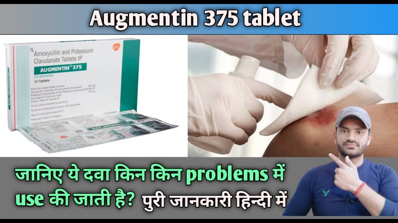 Augmentin 375 tablet use dose benefits and Side effects full review in hindi