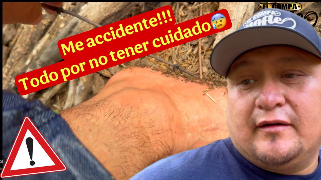 No cometas los mismos ERRORES que yo😰🫣🦶🦶🪨