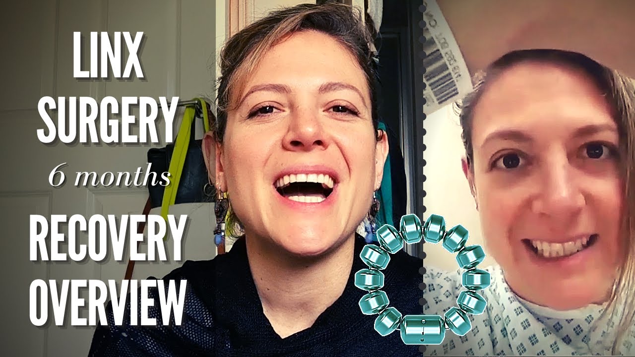 LINX Surgery - 6 Months Recovery Overview | SEE VIDEO UPDATE LINK &darr;