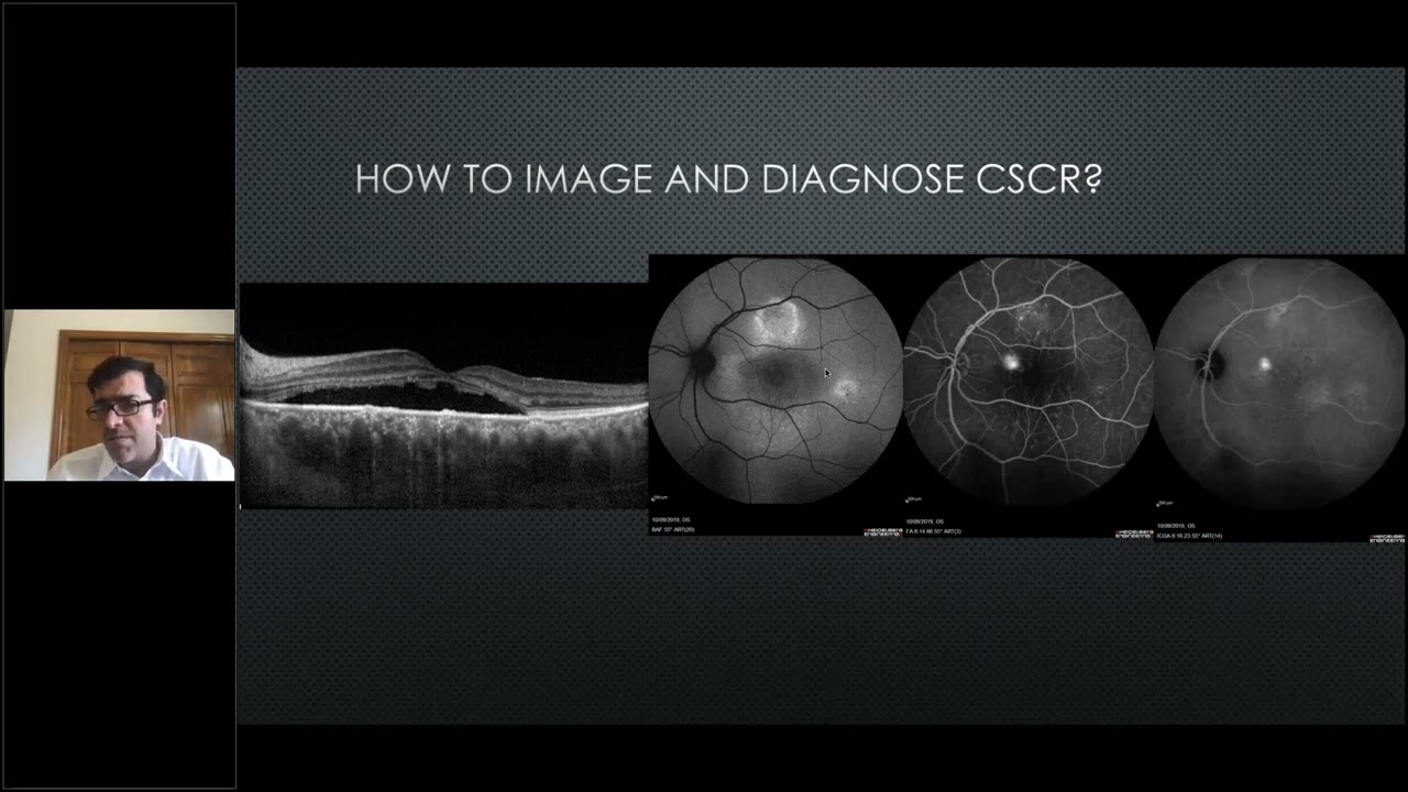 Webinar: CSCR - A deep dive into navigated subthreshold laser treatment strategies