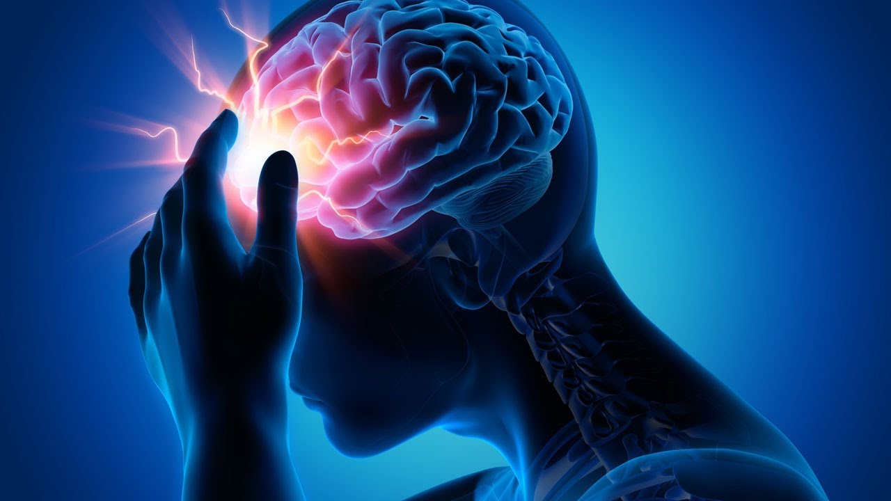 Dore indwara irikwica Abirabura cyane muri iyi minsi: Menya indwara ya Stroke