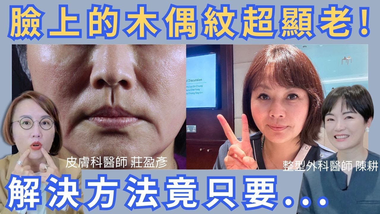 影響木偶紋浮現的三個因素！別再隨便微整填充！如何改善看這裡！
