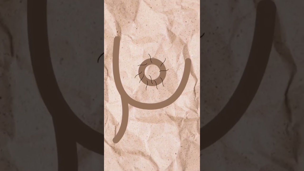 Por si es algo que las acompleja 👀 #doctor #medicina #medstudent #vello #mujeres