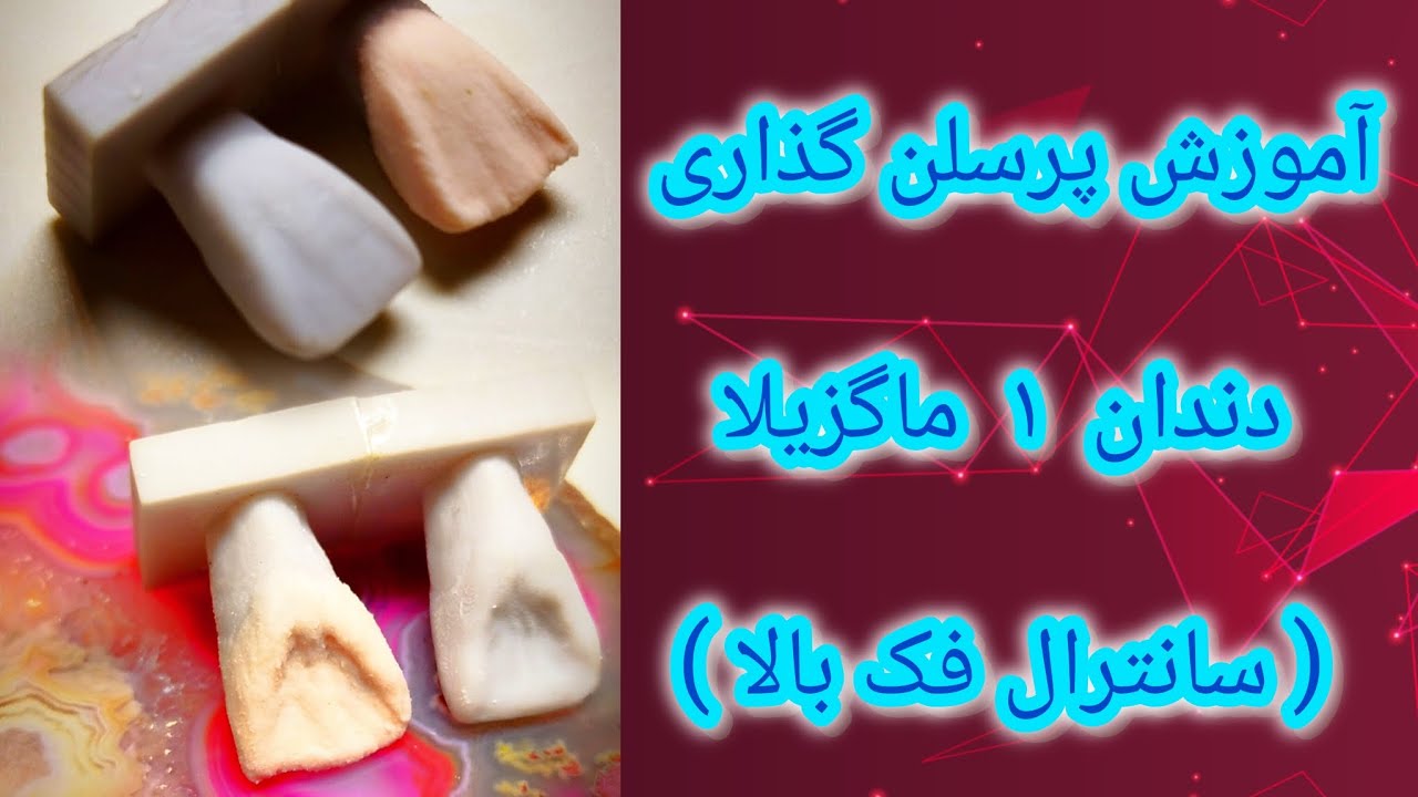 🔥آموزش کامل پرسلن گذاری دندان ۱ فک بالا 🦷| مرحله به مرحله + نکات طلایی🖌️🎨🦷👩🏼‍🔬👩🏼‍⚕️🩻📚🧪📖