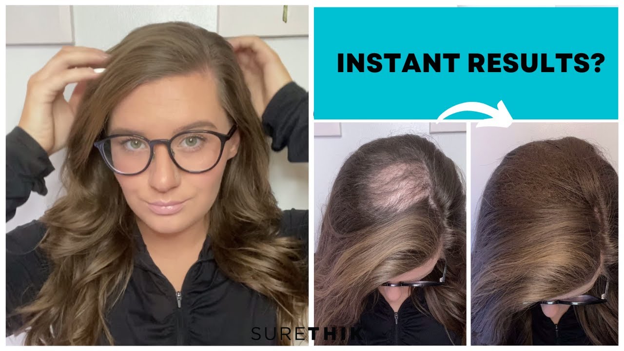 Fill in your Bald Spots Instantly with SureThik Hair Fibers