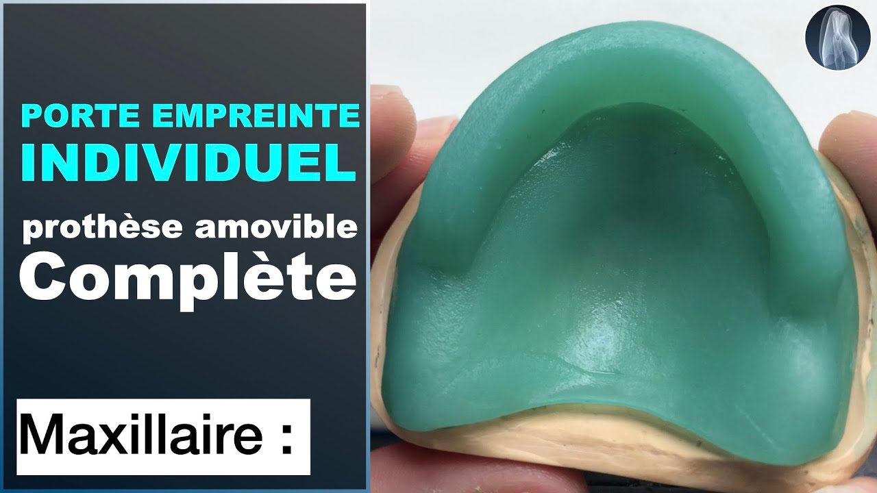 Comment concevoir un porte-empreinte individuel pour une prothèse amovible complète maxillaire