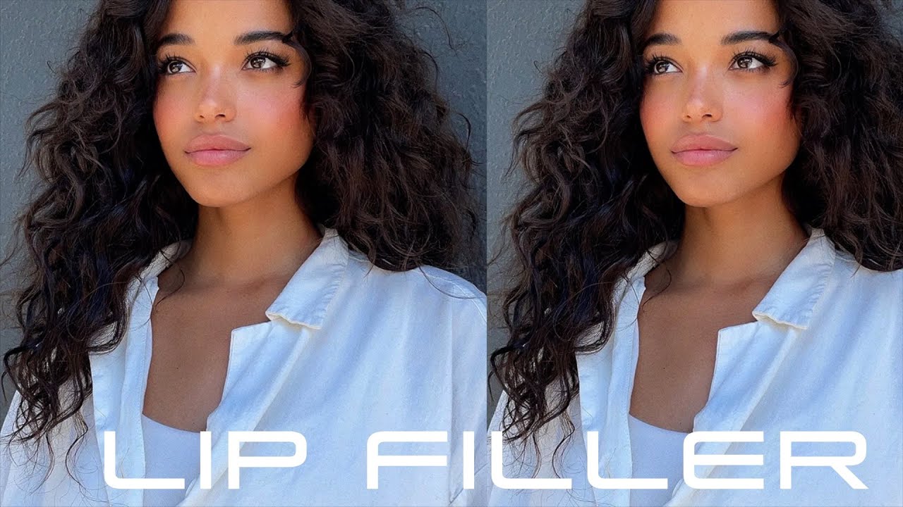 Lip Filler - Full Plump Symmetrical Lips