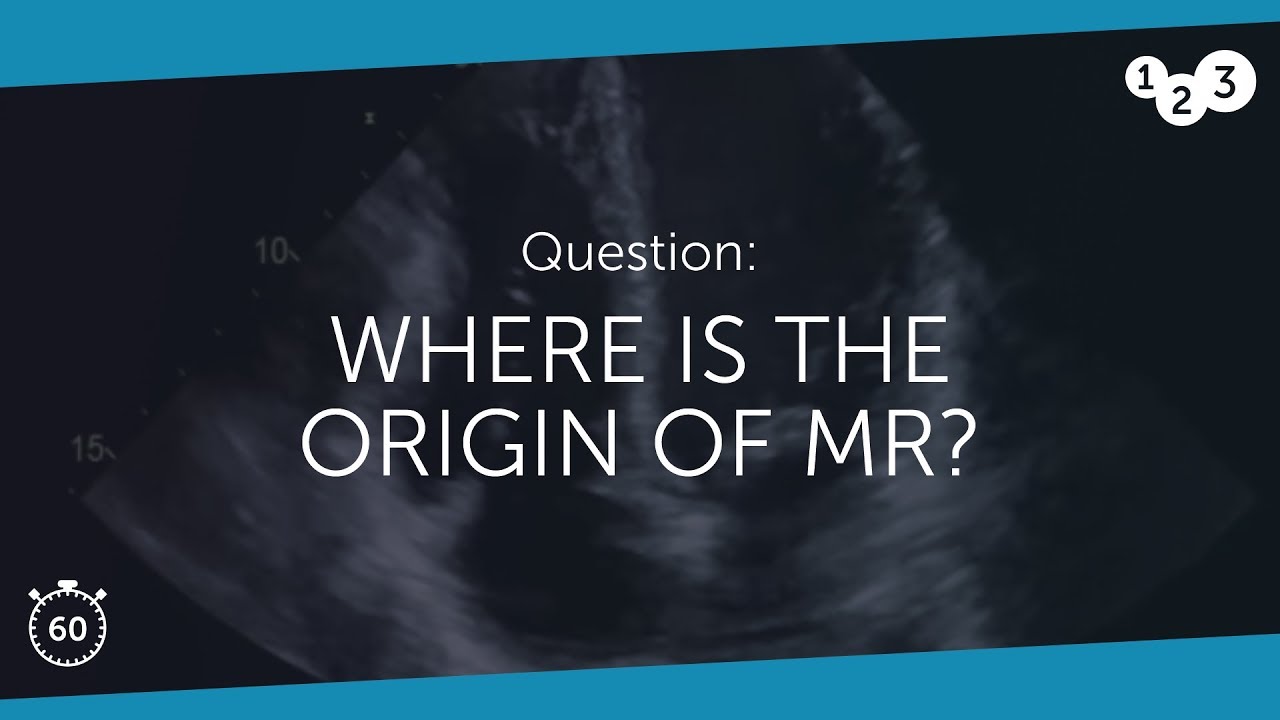 60 Seconds of Echo Teaching Question: Where is the origin of MR?