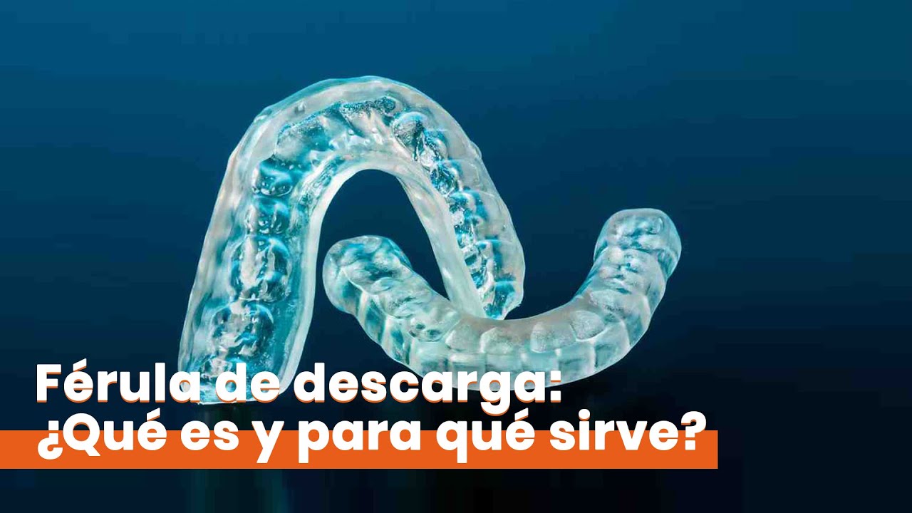 Clínica Dental Figueras - Férula de Descarga: ¿Qué es y para qué sirve?