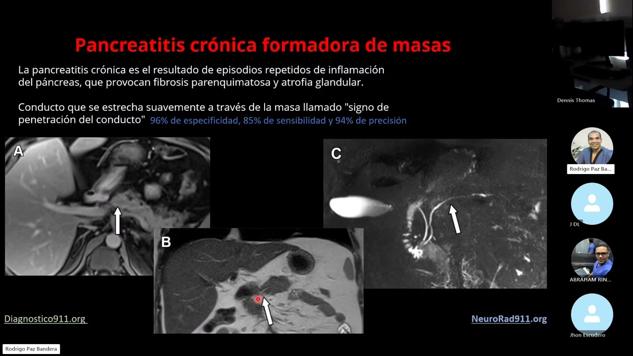 Cancer de Páncreas y sus Imitadores