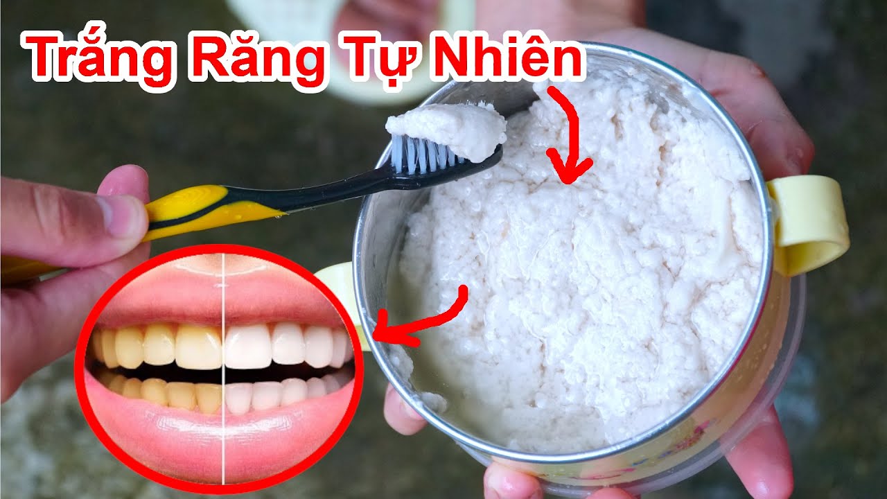 Cách Làm Trắng Răng Nhanh Chóng Từ Kem Đánh Răng Thảo Dược Tự Nhiên / Làm Kem Đánh Răng Từ Trái Dừa