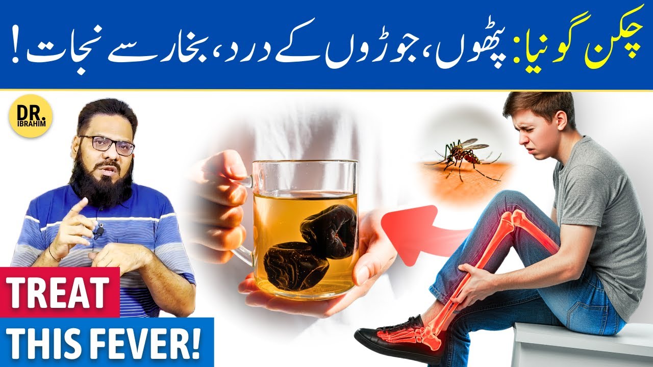 Chikungunya Ka Ilaj Herbal Se! Pathon, Joro Ke Dard, Bukhar Se Nijat! Dr. Ibrahim