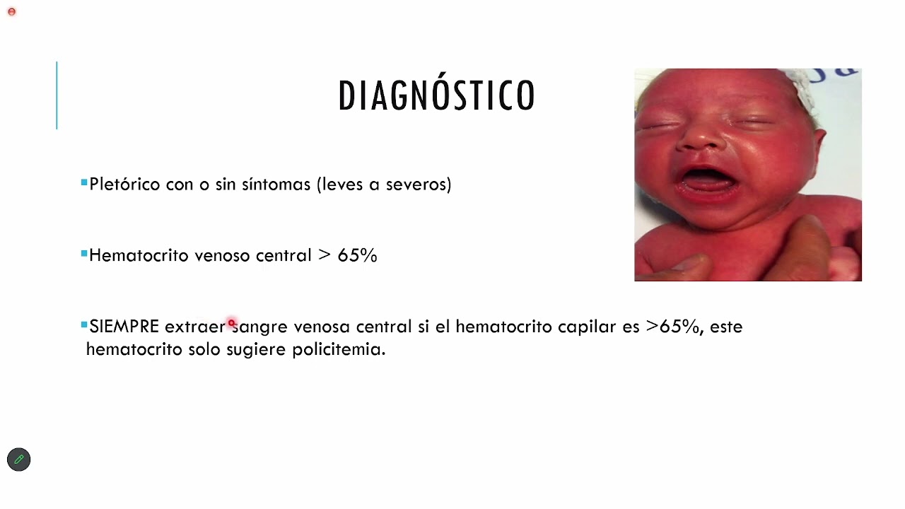 T 24 Policitemia Neonatal en RN de bajo peso y post-t&eacute;rmino. Dr. Mu&ntilde;oz  21 04 2023