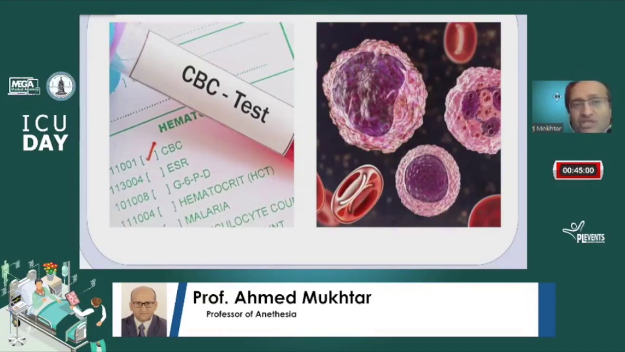 Sepsis Recognition. by Prof Ahmed Mukhtar