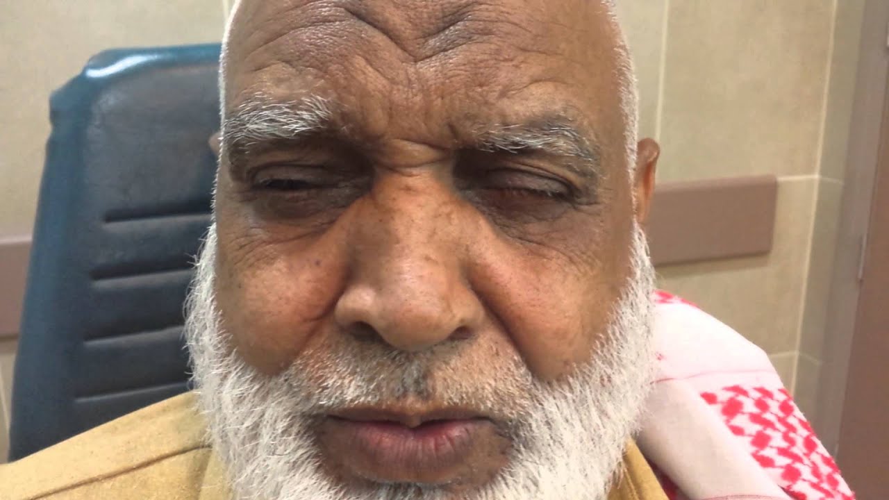 Essential Blepharospasm