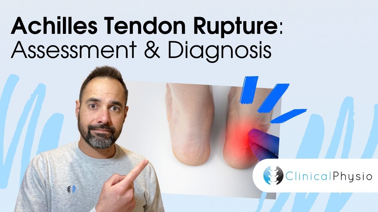 Achilles Rupture: Assessment and Diagnosis | Expert Physio Review