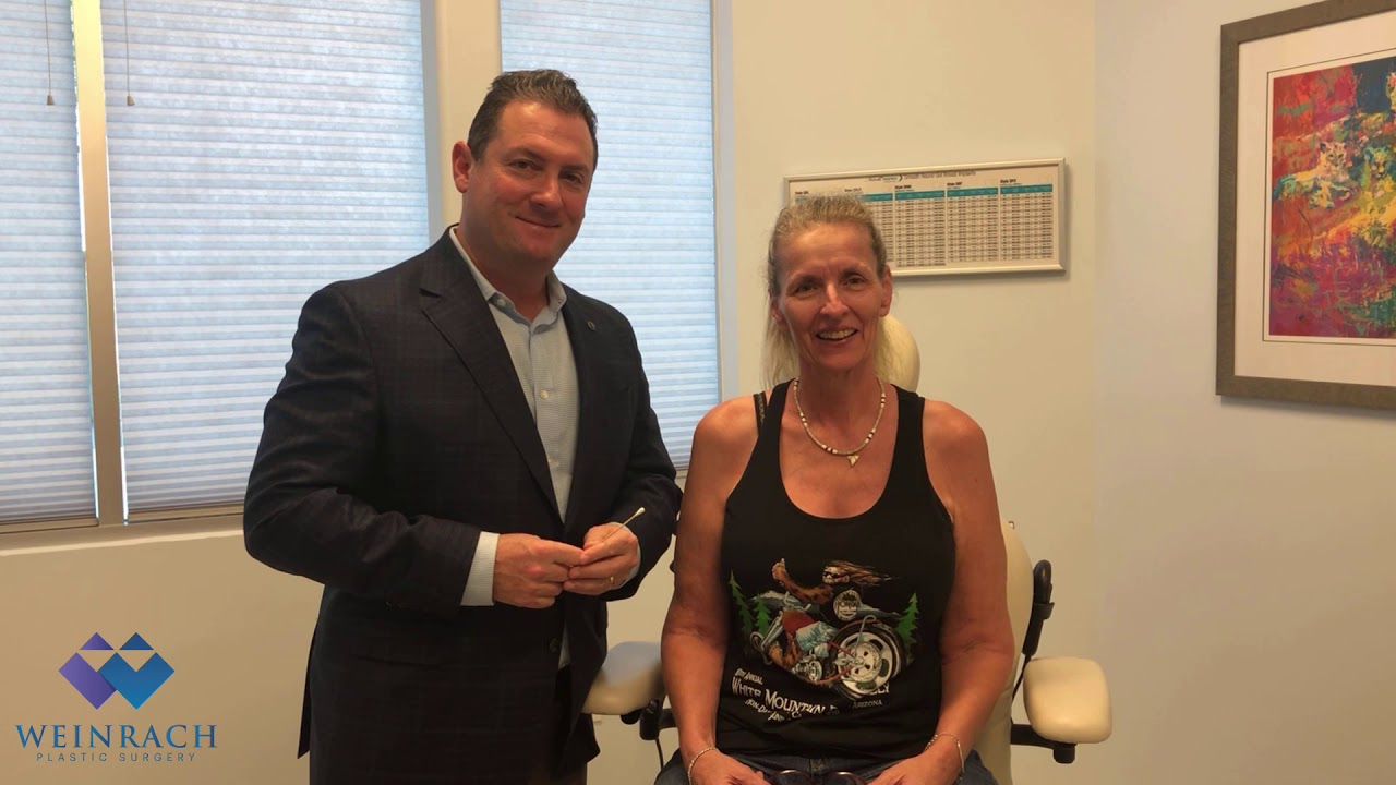 Facelift Browlift Eyelid Lift Neck Lift Happy Patient Testimonial