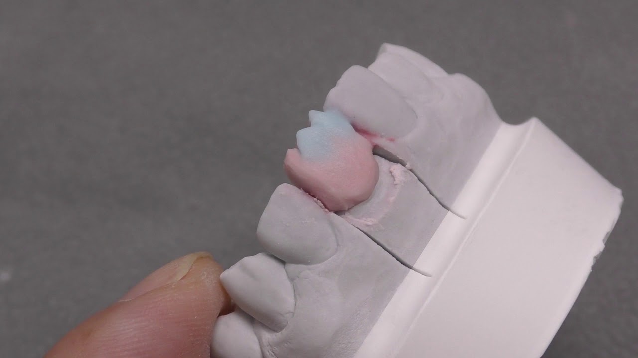 CZR Direction for Use – Body, Enamel, Translucent –