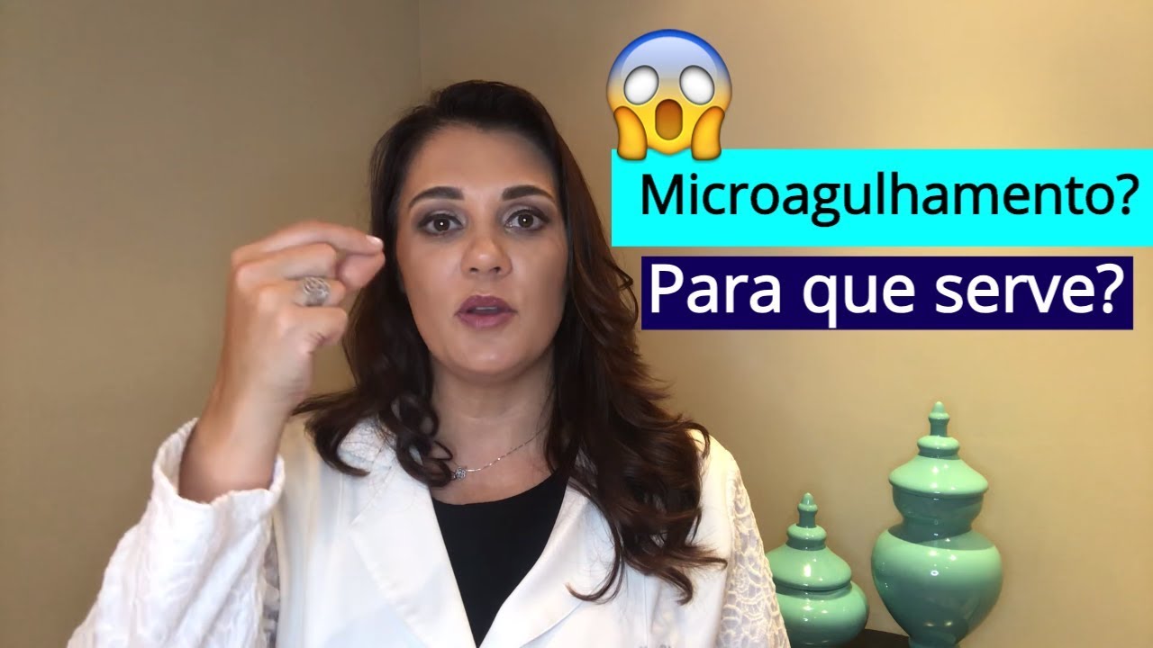 Para que serve Microagulhamento?