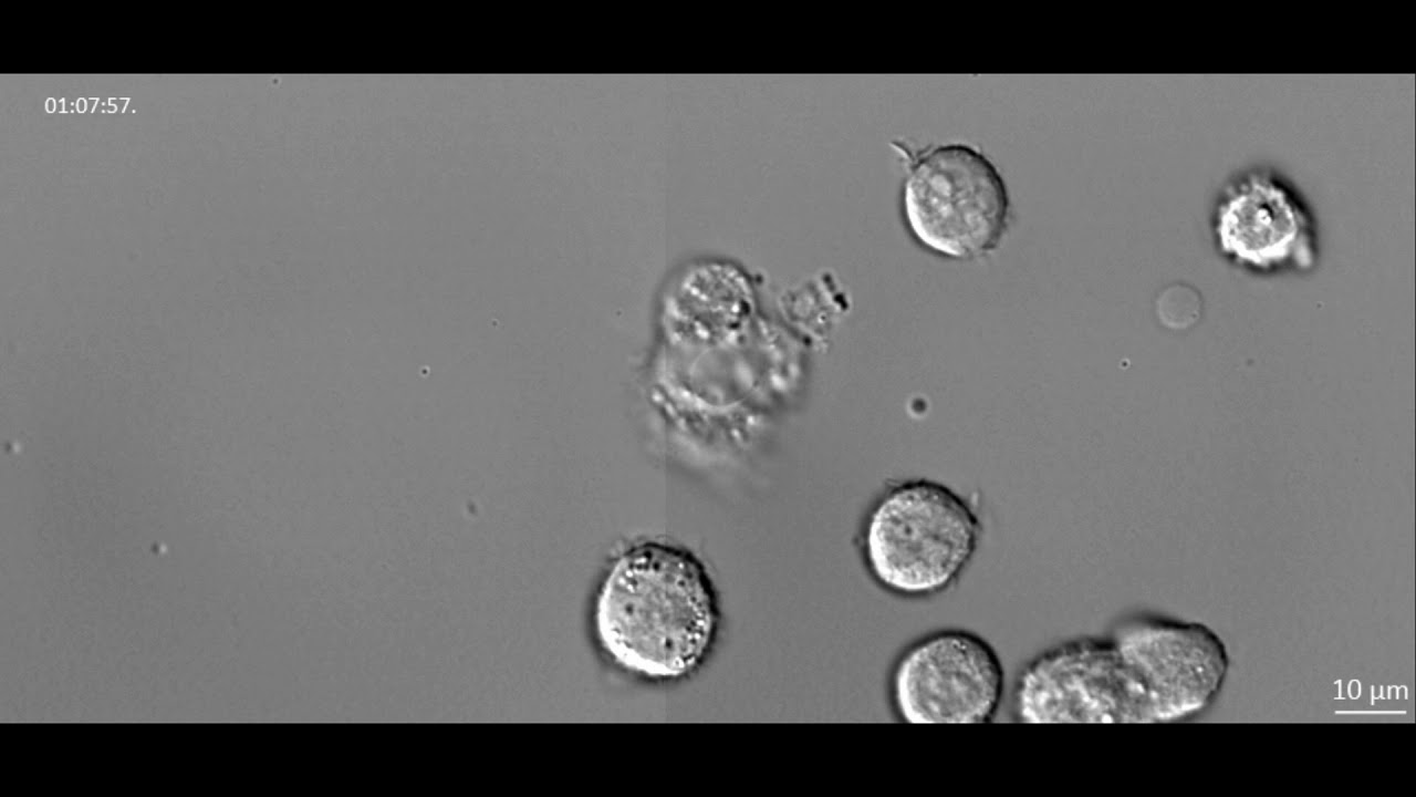 White Blood Cell Death