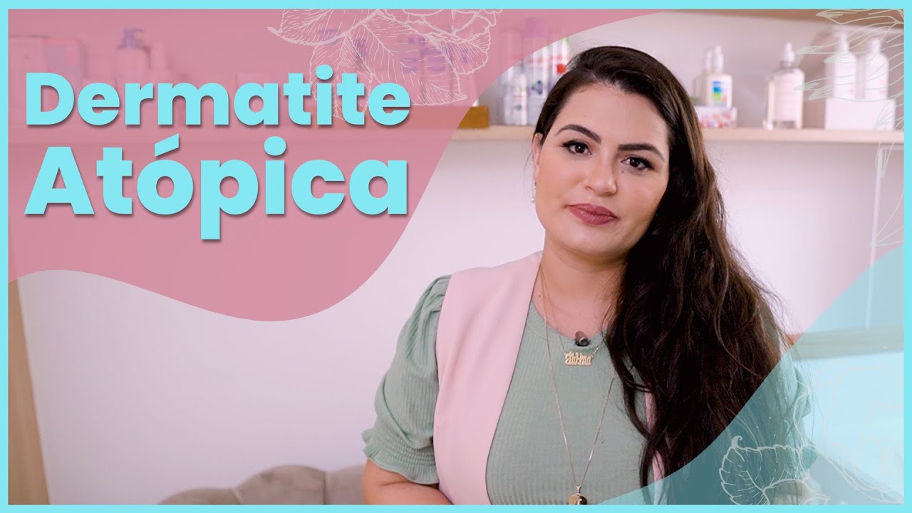 DERMATITE AT&Oacute;PICA - O QUE &Eacute;? COMO TRATAR? CAUSAS E TRATAMENTO