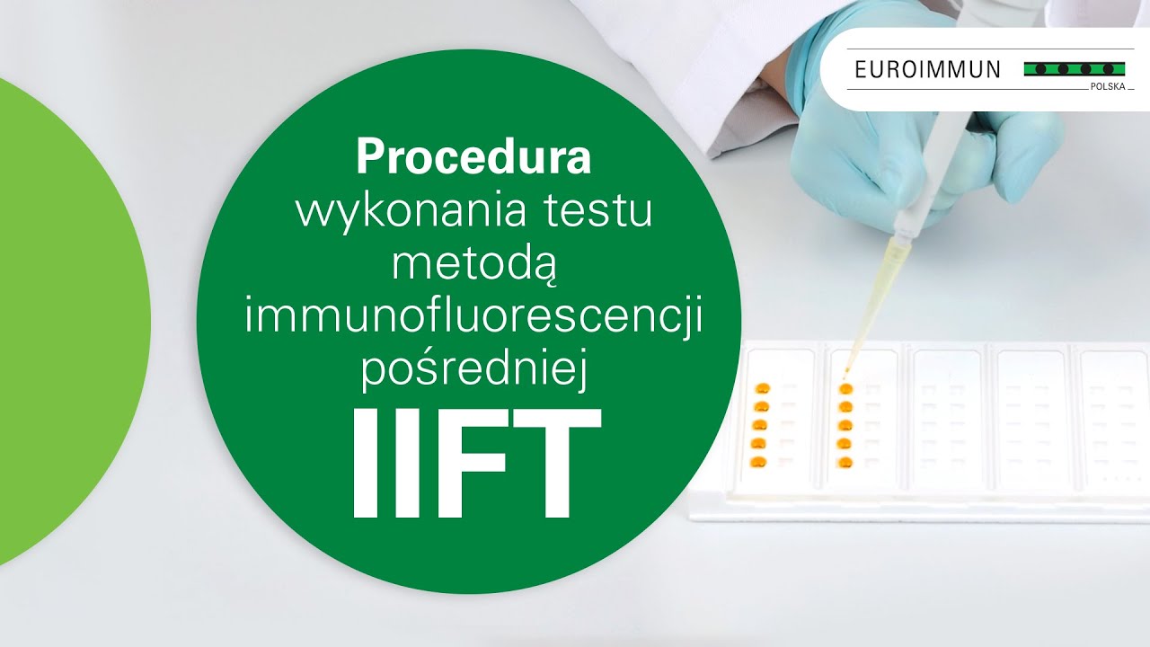 Procedura wykonania testu metodą immunofluorescencji pośredniej