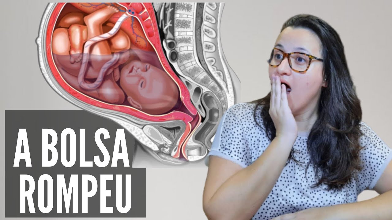 A bolsa rompeu? O que fazer?