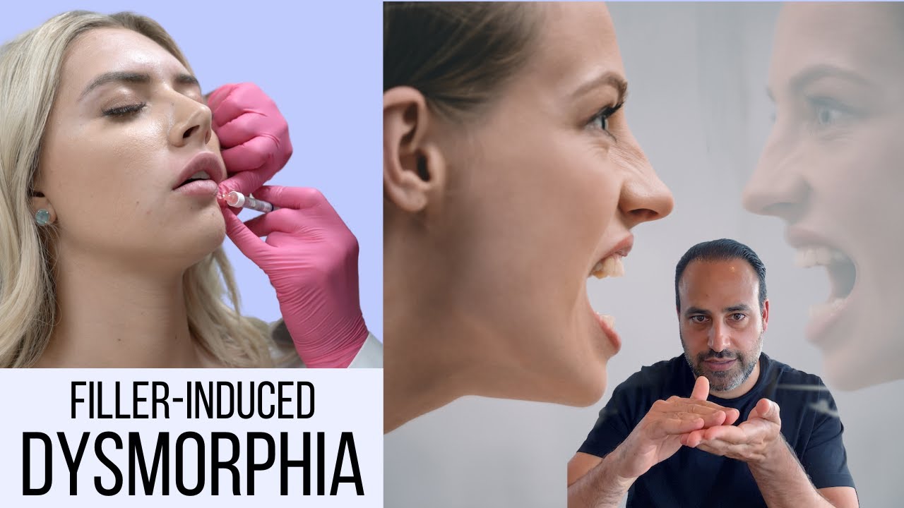 Dissolver Induced Dysmorphia - This Is What You Need To Know