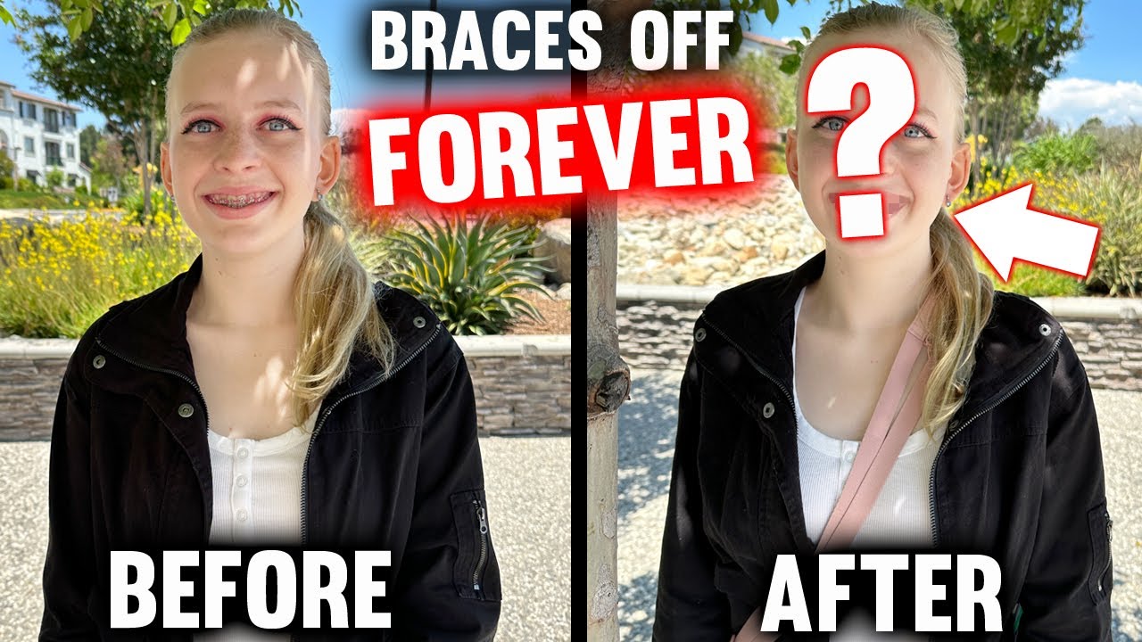 ALYSSA GETS HER BRACES OFF after 8 years!!!