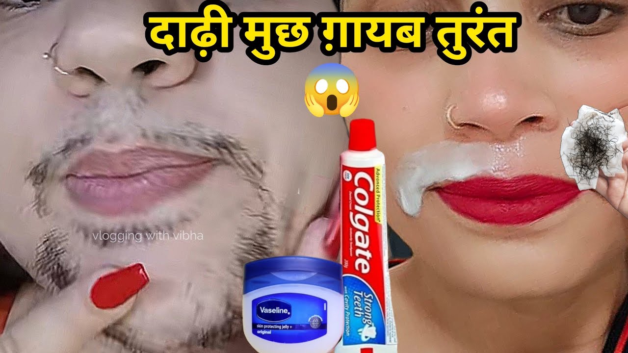 बिना Wax👉दो बूंद लगते ही 44 साल भाभी जी के चेहरे से दाढ़ी,मूछ साफ😱|| facial hair treatment in Hindi