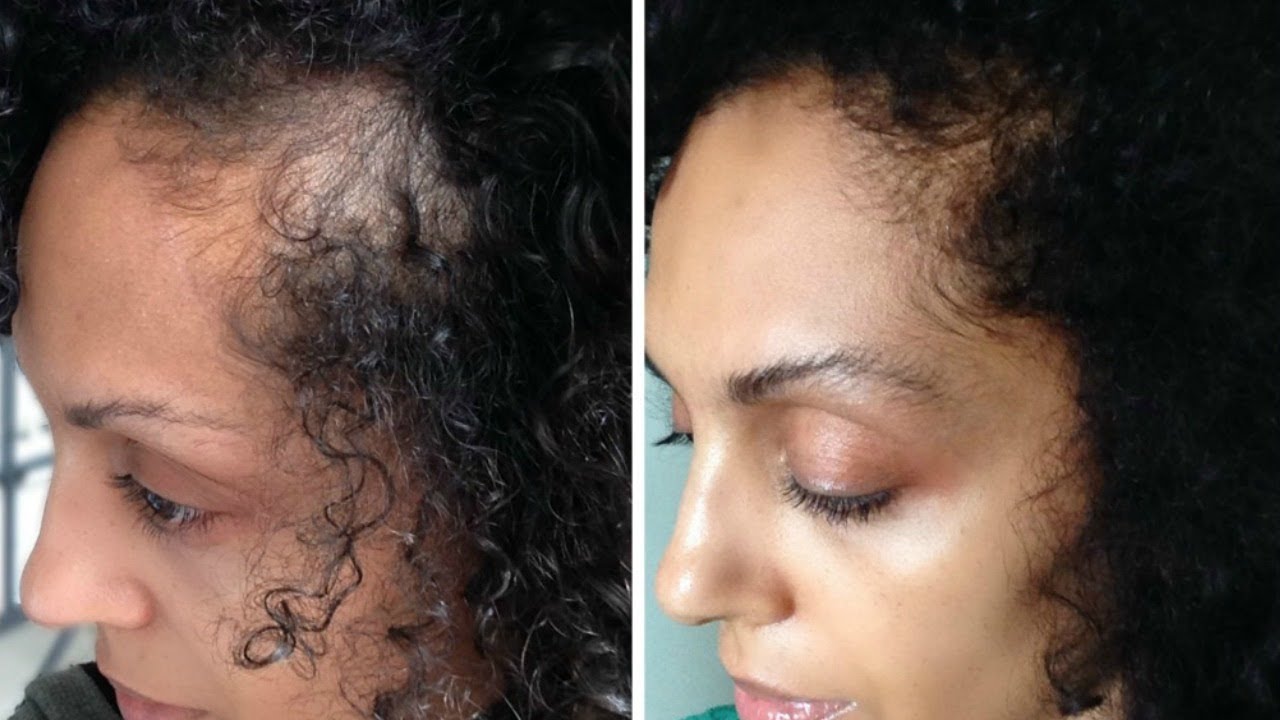 HOW TO: GROW YOUR EDGES BACK FAST!!! UPDATE | DISCOCURLSTV