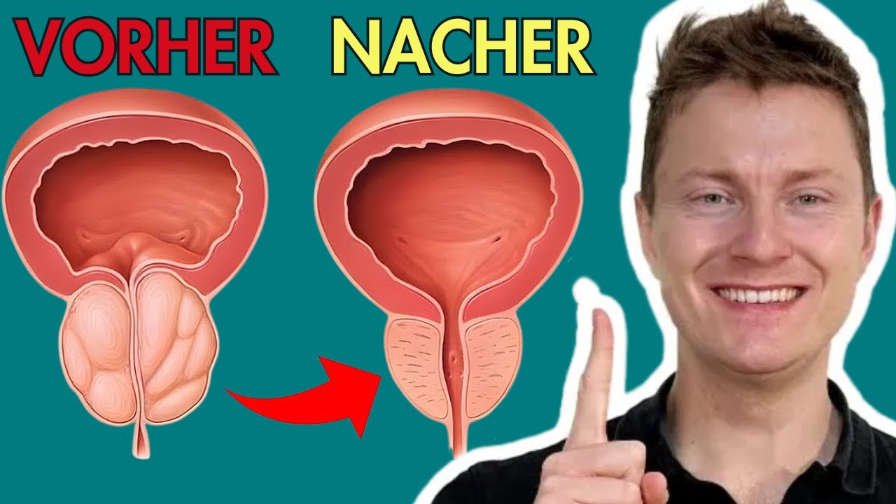 BECKENBODENTRAINING f&uuml;r M&Auml;NNER 💪: Die EINE PROSTATA-&Uuml;BUNG, die ALLES ver&auml;ndert